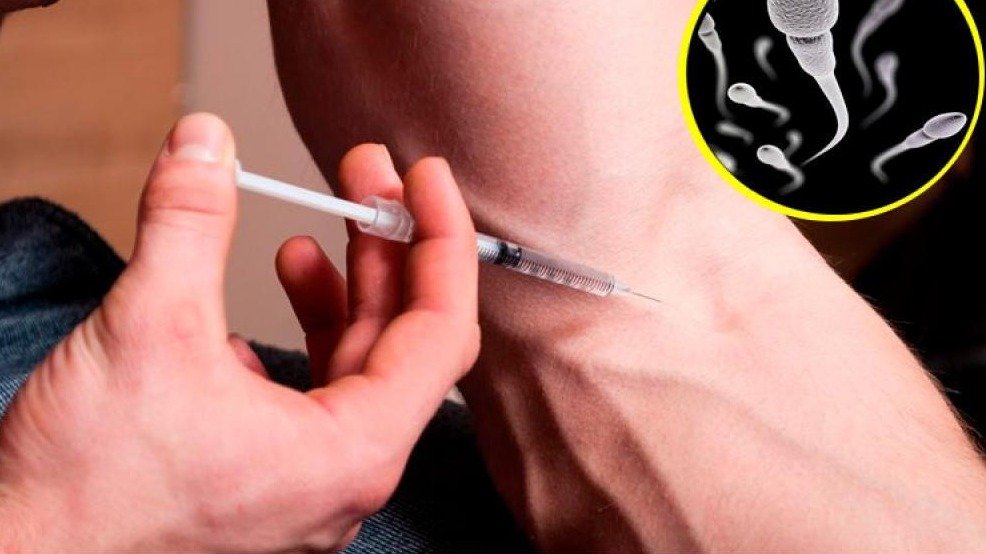 Hombre se inyecta su propio semen para curarse el dolor de espalda Hombre se inyecta su propio semen para curarse el dolor de espalda