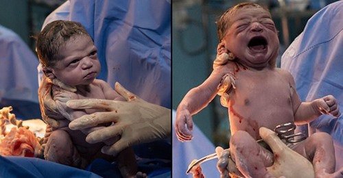 Fotografo Capturo Fotos De Una Bebe Recien Nacida Cuando Le Frunce El Ceno Al Medico Red Uno De Bolivia