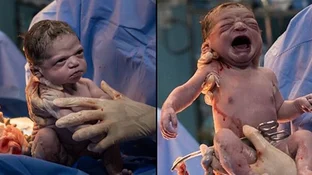 Fotografo Capturo Fotos De Una Bebe Recien Nacida Cuando Le Frunce El Ceno Al Medico Red Uno De Bolivia Fotografo Capturo Fotos De Una Bebe Recien Nacida Cuando Le Frunce El Ceno Al Medico Red Uno De Bolivia