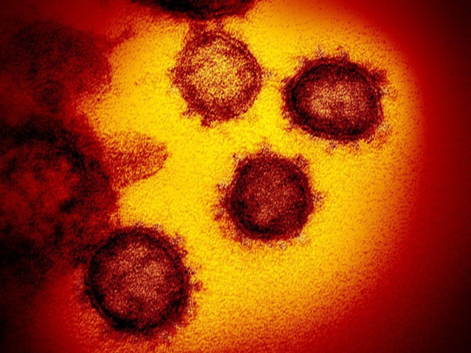 Caso sin precedentes: un islandés contrajo dos cepas diferentes de coronavirus al mismo tiempo