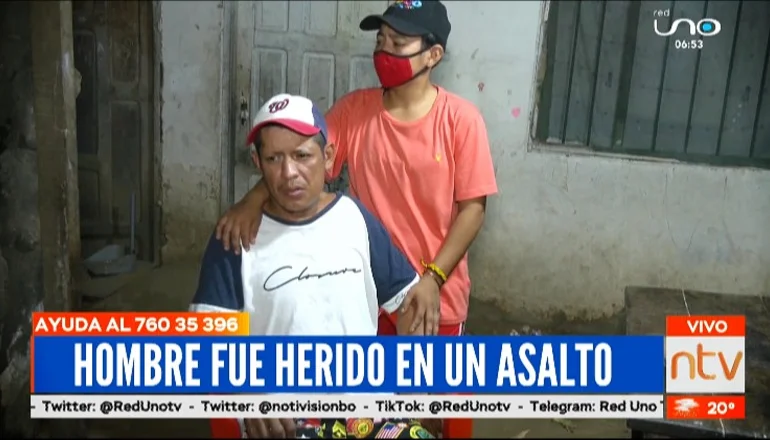 Ataque Brutal Por Bs 2 Hombre Sufre Fractura De Mandíbula Tras Ser