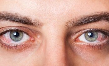 Tus ojos pueden revelar qué problema de salud padeces 