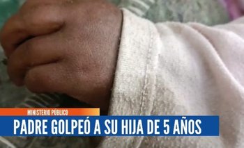 En Oruro un varón agrede a su hija de 5 años con un cable