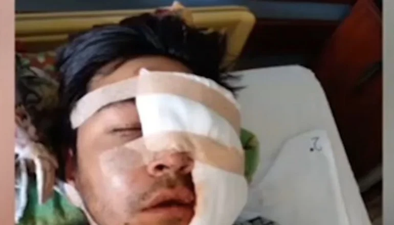 Red Uno_ Poblador fue atacado por dos hermanos con una picota.