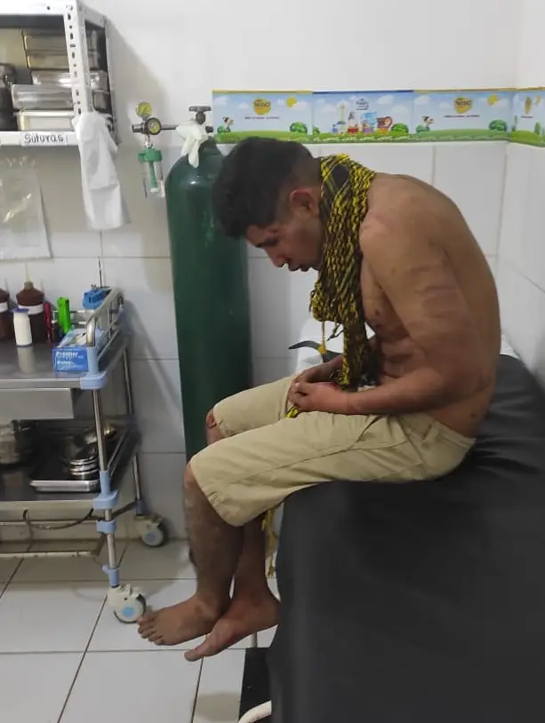 Sujeto acusado de intento de violación en Satélite Norte.