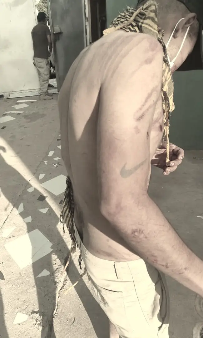 El agresor sexual fue entregado a la Policía.