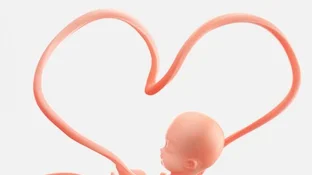Nace Bebe Con El Cordon Umbilical Enrollado Al Cuello 6 Veces Red Uno De Bolivia Nace Bebe Con El Cordon Umbilical Enrollado Al Cuello 6 Veces Red Uno De Bolivia