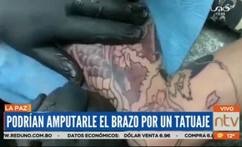 Wilson Condori podría sufrir amputación de brazo a causa de un tatuaje