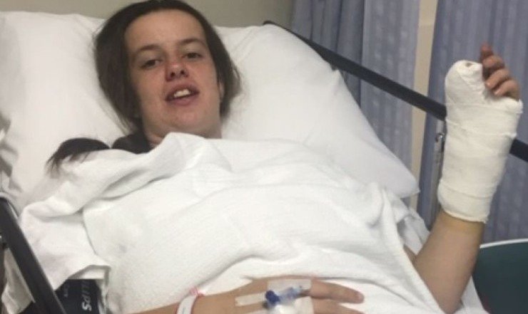 Le implantaron un dedo del pie en la mano — Herror médico Le implantaron un dedo del pie en la mano — Herror médico
