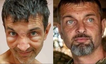 El terrible aspecto de un prisionero de guerra ucraniano tras ser liberado del cautiverio ruso 