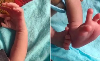 Nació una bebé con 26 dedos y aseguran que es reencarnación de una diosa hindú