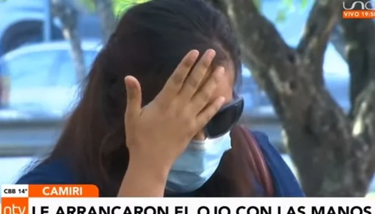 Mujer pierde el ojo tras ser agredida por su sobrina en Camiri