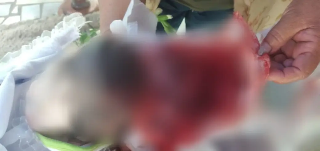 "El bebé tenía un hueco en la cabeza": Denuncian un caso de negligencia médica